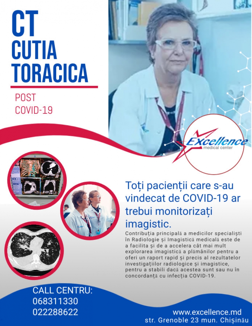 Toți pacienții care s-au vindecat de COVID-19 ar trebui monitorizați imagistic