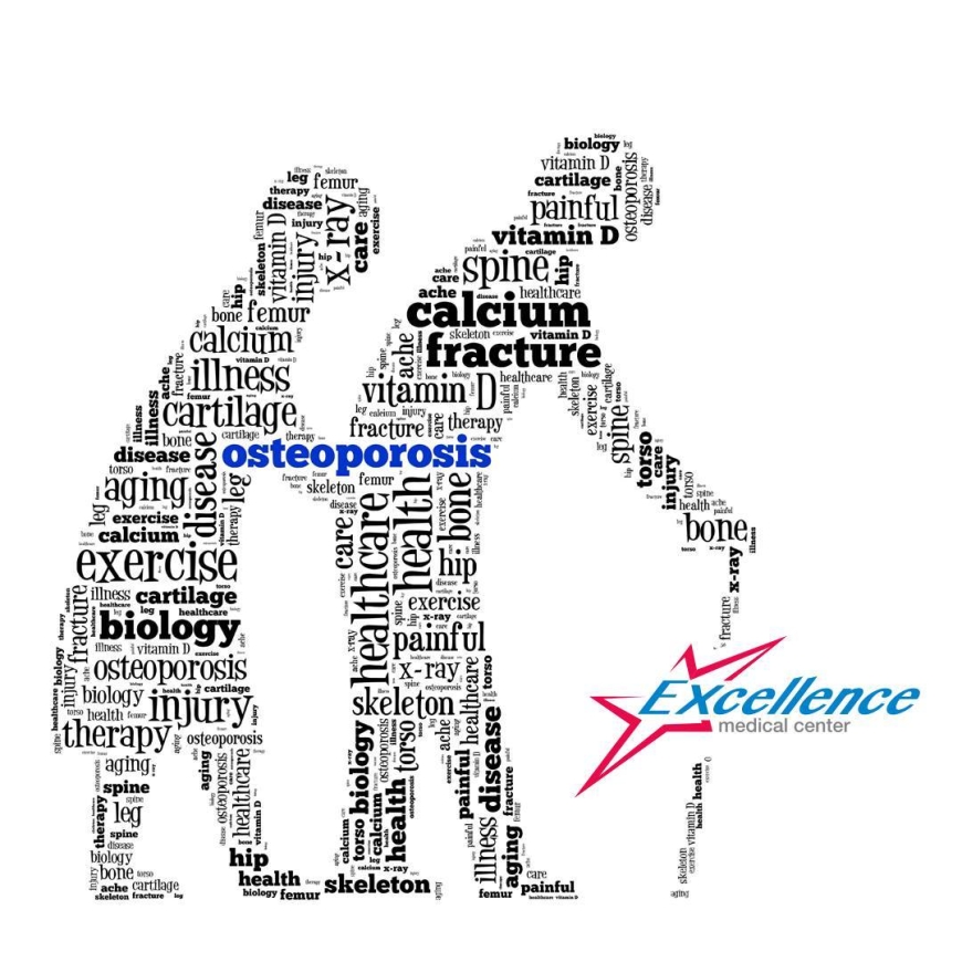 DEXA. Osteodensitometria